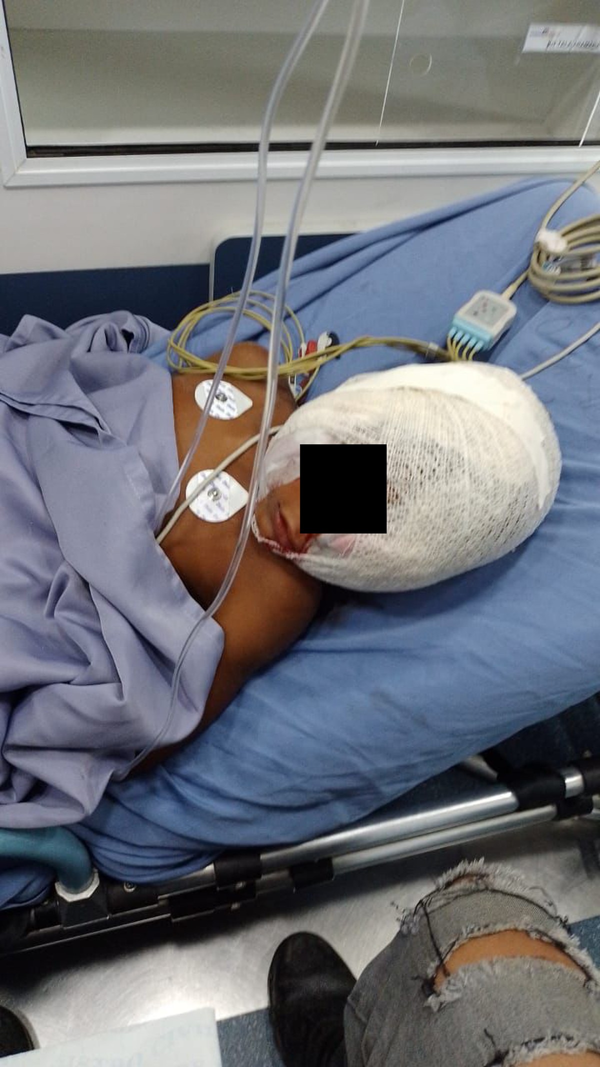 Menino de 5 anos é atacado por pitbull em São Pedro da Aldeia | Região dos Lagos