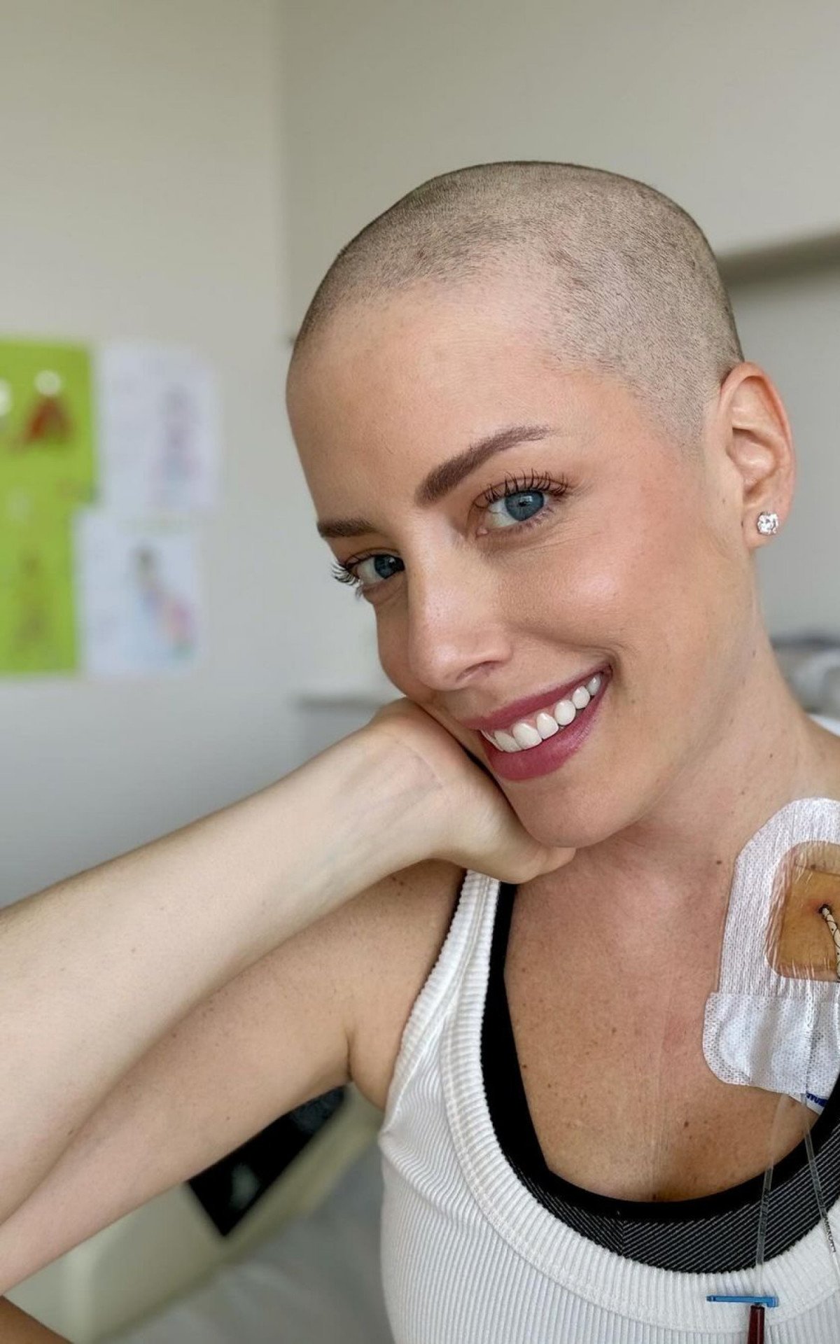 Fabiana Justus raspa o cabelo em tratamento contra leucemia | Celebridades