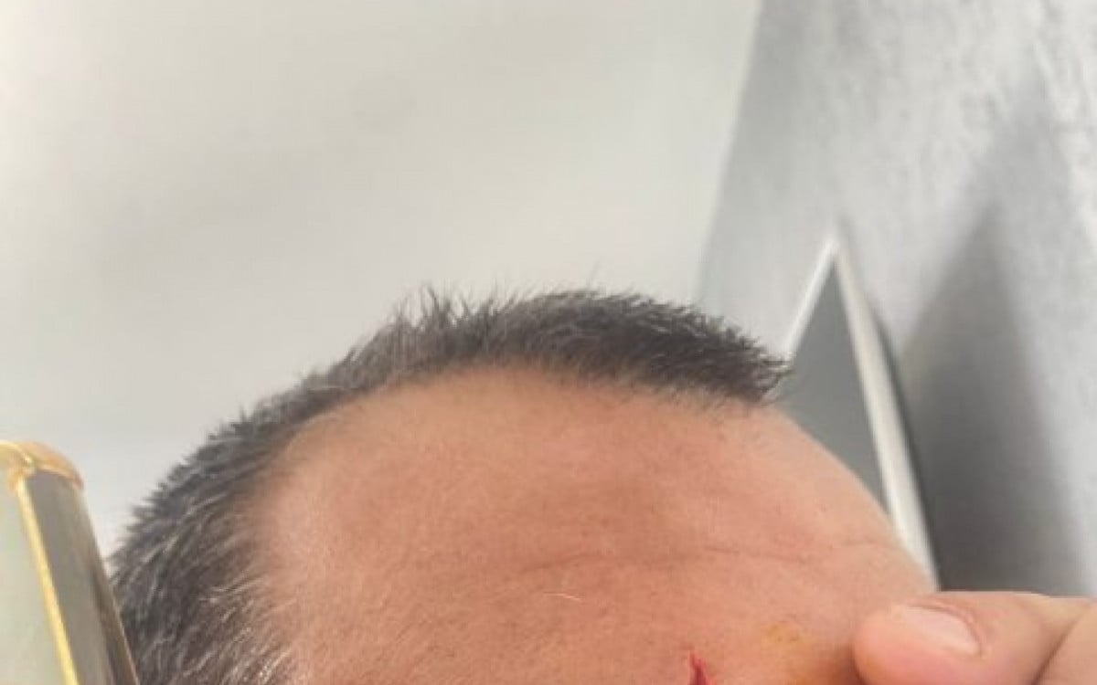 Pitbull ataca casal em Arraial do Cabo | Arraial do Cabo - Rio de Janeiro