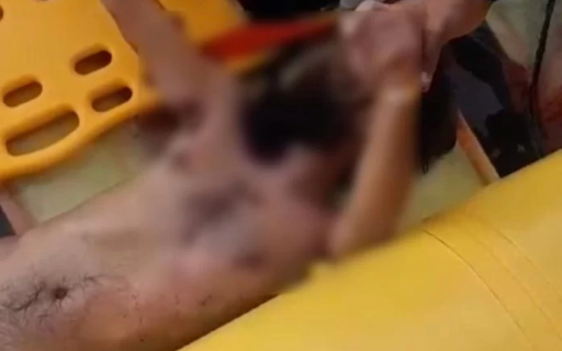 Homem fica gravemente ferido após pular de barco em Arraial do Cabo | Arraial do Cabo - Rio de Janeiro