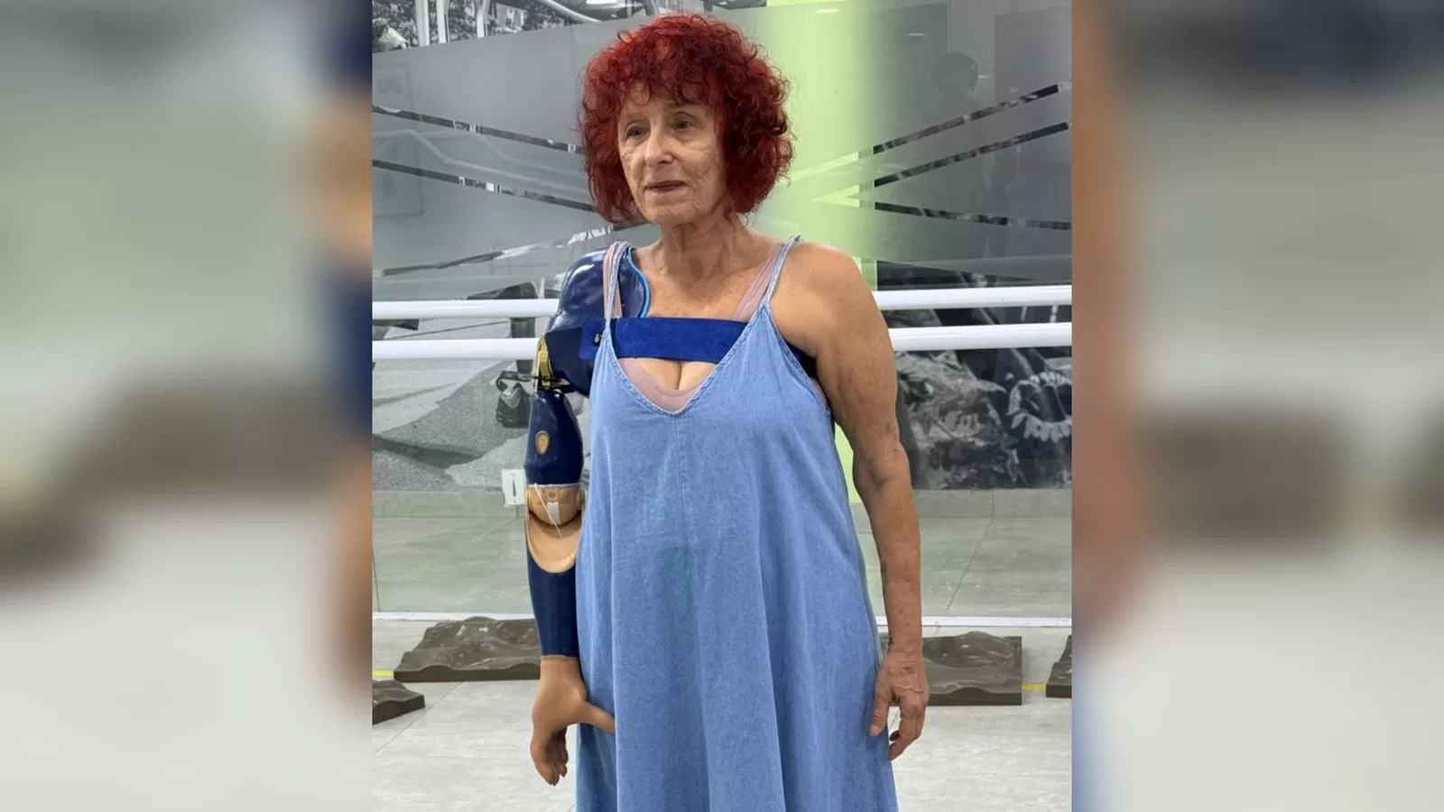 Escritora Roseana Murray inicia uso de prótese biônica após ataque de pitbulls em Saquarema — RC24H