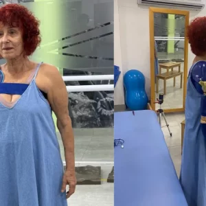 Escritora atacada por pitbulls recebe prótese de braço | Enfoco
