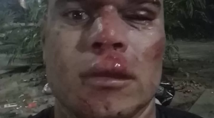 Homem é atacado em tentativa de furto de celular em bloco de Carnaval em Araruama