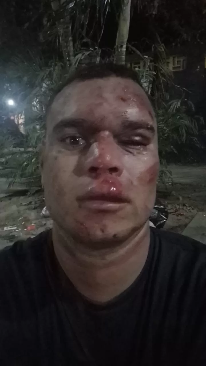 Homem é agredido durante tentativa de roubo de celular em bloco de Carnaval em Araruama — RC24H