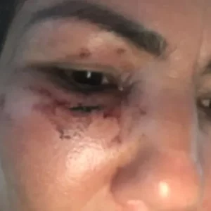 Motorista de app é agredida por passageira em Saquarema; vídeo | Enfoco