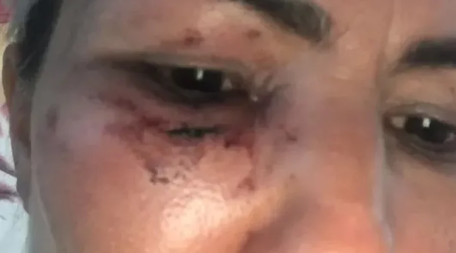 Araruama: Motorista de aplicativo é atacada por passageira em Saquarema; vídeo