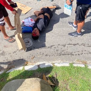 Acidente grave entre moto e carro deixa uma pessoa ferida em Armação dos Búzios