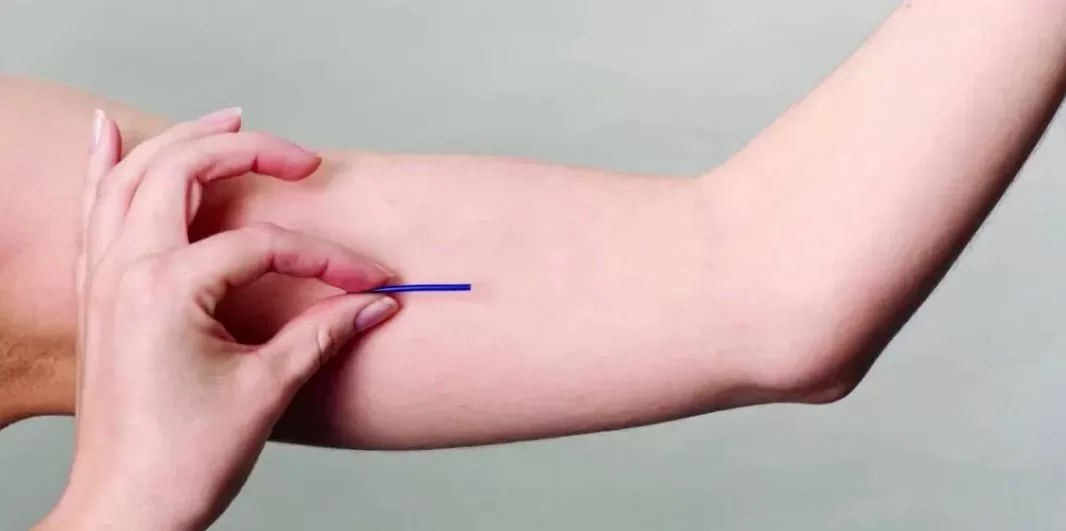 Araruama inicia oferta de implante contraceptivo na rede municipal de saúde — RC24H