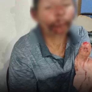 Homem em situação de rua agride pescador de Iguaba com facão e pauladas em tentativa de roubo | Iguaba Grande