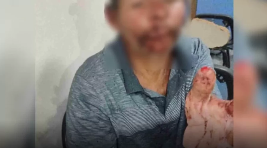 Homem sem-teto ataca pescador em Iguaba Grande com arma branca e golpes na tentativa de assalto.