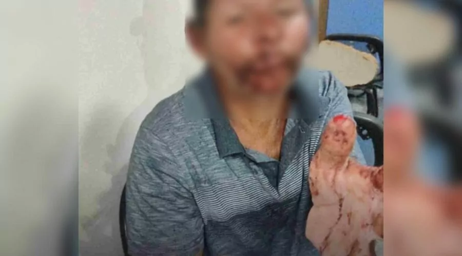 Homem sem-teto ataca pescador com facão e espancamento em tentativa de roubo em Iguaba Grande